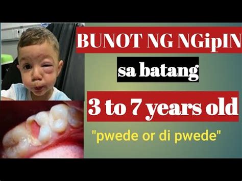 Bunot ng ngipin in English with contextual examples .